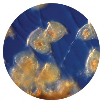 Vorticella, Living