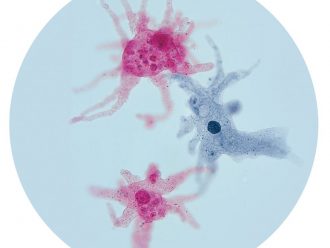 Protozoan Mixture, Living