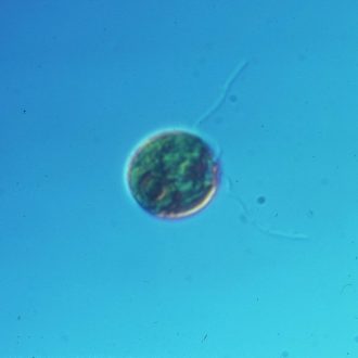 Chlamydomonas, Large Form, Living