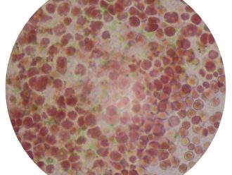 Porphyridium, Living