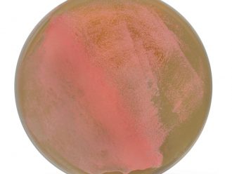 Halobacterium sp. NRC-1, Living, Plate