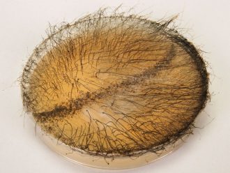 Zygospore Demonstration Plate (Phycomyces)