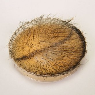 Zygospore Demonstration Plate (Phycomyces)