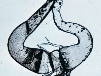 Phlyctochytrium (Spizellomyces) dolichospermus, Living, Tube