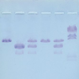 DNA and Marker Only (from 211018)