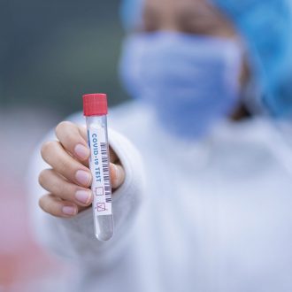 P51™ COVID qPCR Lab: Detecting SARS-CoV-2 Infection