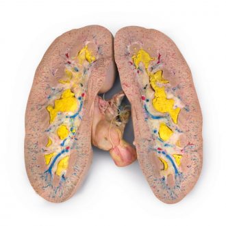 Carolina's Perfect Solution® Pig Kidney, Triple Injection, 1 Per Bag