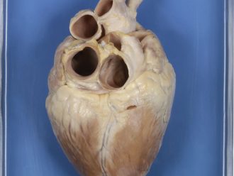 Preserved Demonstration Pig Heart