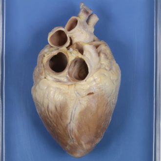 Preserved Demonstration Pig Heart