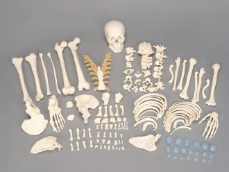 Somso® Disarticulated Human Skeleton with Storage Case, Not Number Coded