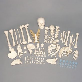 Somso® Disarticulated Human Skeleton with Storage Case, Not Number Coded