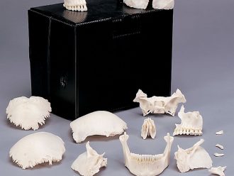Somso® Human Skull, Disarticulated, Plastic
