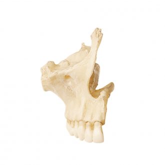 Somso® Loose Human Skull Bone, Right Superior Maxilla