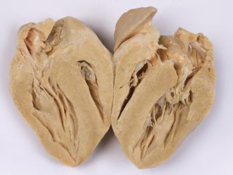 Plastinated Dissected Pig Heart