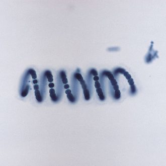 Anabaena Slide, w.m.
