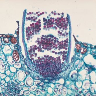 Puccinia graminis Aecia sec., 12 µm Microscope Slide