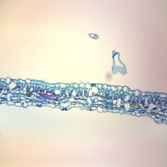 Tobacco Mosaic Virus, Microscope Slide