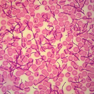 Bacteria and Blood, w.m. Microscope Slide