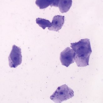 Human Stratified Squamous Epithelium Slide, Smear