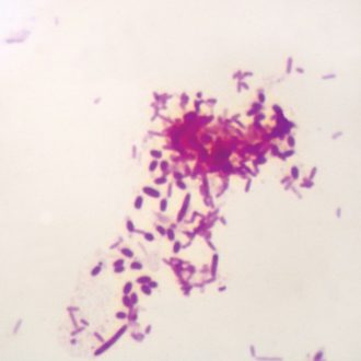 Pseudomonas aeruginosa, w.m. Microscope Slide