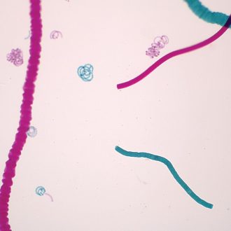 Mixed Blue-Green Algae, w.m. Microscope Slide