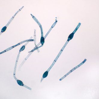 Oedogonium Macrandrous, w.m. Microscope Slide