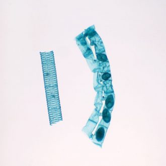 Spirogyra Scalariform Conjugation, Vegetative and Zygote Stages, w.m. Microscope Slide