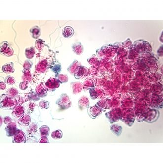 Vorticella Slide, w.m.