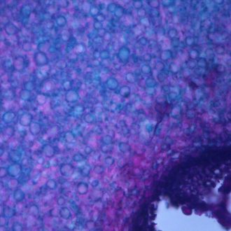 Claviceps purpurea Mature Sclerotium, c.s., 12 µm Microscope Slide