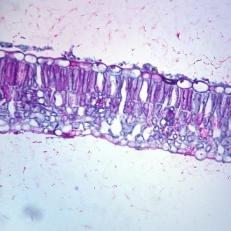 Lilac Mildew, section Microsphaera, Microscope Slide