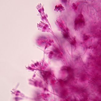 Penicillium Slide, w.m.
