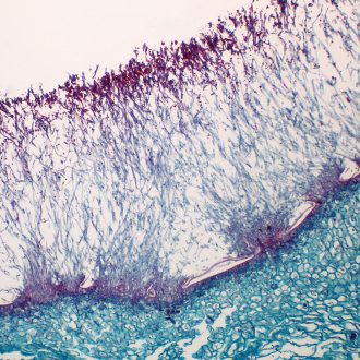 Penicillium, sec., 12 µm Microscope Slide