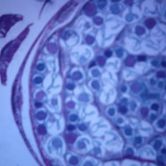 Polytrichum (Moss) Leaves, c.s., 12 µm Microscope Slide