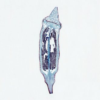 Moss Mature Capsule, median l.s., 12 µm Microscope Slide