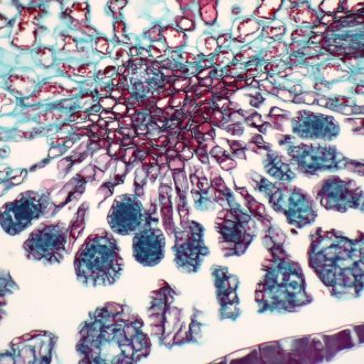 Fern Mature Sporangia, c.s., 12 µm Microscope Slide