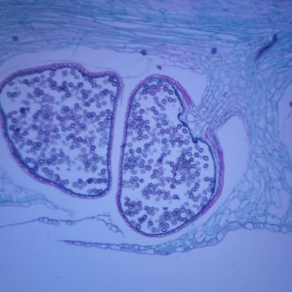 Lycopodium Strobilus, l.s., 12 µm Microscope Slide