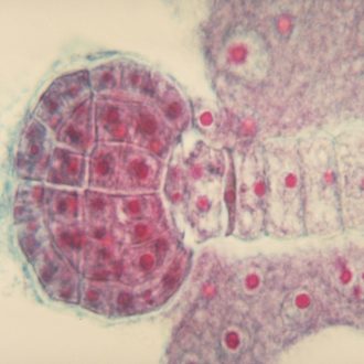 Shepherd's Purse (Capsella) Young Embryo, l.s., 12 µm Microscope Slide