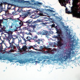 Ectotrophic Mycorrhiza, c.s., 12 µm Microscope Slide