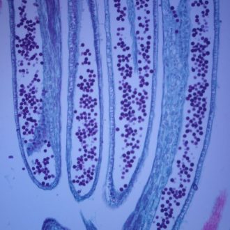 Buttercup Flower Bud, l.s., 12 µm Microscope Slide