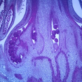 Tomato Flower Bud, l.s., 12 µm Microscope Slide