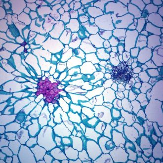 Pear Fruit (Pyrus), cross section, Microscope Slide