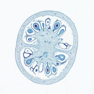 Tomato Fruit, c.s., 12 µm Microscope Slide