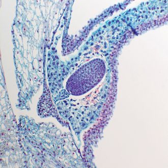Lily Fruit Slide, c.s., 12 µm