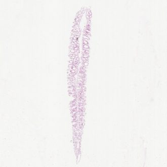 Grantia, Near median l.s. Microscope Slide