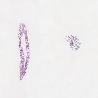 Grantia, c.s. and l.s. Microscope Slide