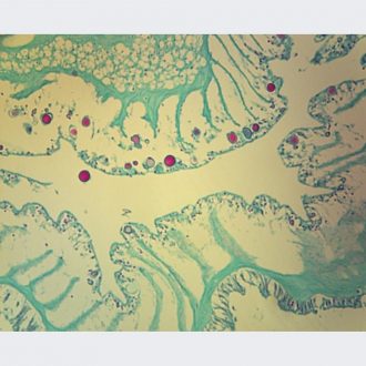 Physalia Tentacle, c.s., Mallory's Stain Microscope Slide
