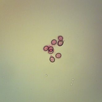 Echinococcus granulosus Eggs, w.m. Microscope Slide