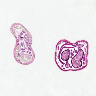 Ascaris suum Male and Female Slide, c.s., 8-10 µm, H&E