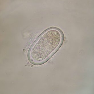 Enterobius vermicularis Eggs, w.m. Microscope Slide