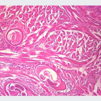 Human Helminth Eggs, w.m. Microscope Slide